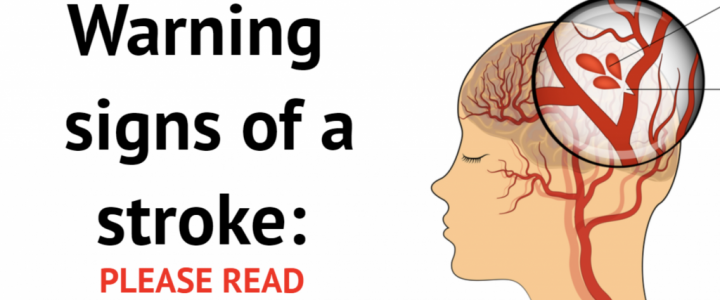 Warning signs of a stroke – PLEASE READ