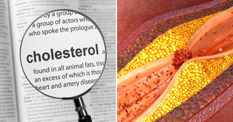 The Cholesterol Myth Has Been Busted — Yet Again